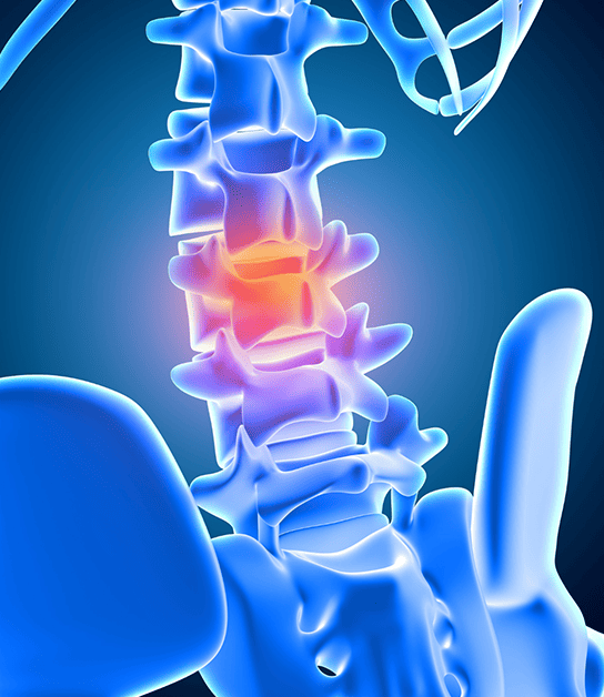 <strong>Clínica de cirugía</strong> de <strong>columna</strong> <strong>lumbar en </strong>Hospital Star Médica Chihuahua y Élite Centro Médico
