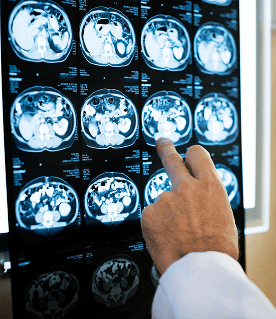 <strong>Neurocirugía en Chihuahua</strong>: Expertos en cirugía cerebral y de columna