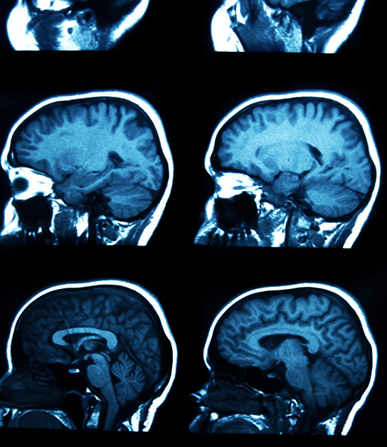 <strong>WhatsApp de consulta</strong> de <strong>neurocirugía en </strong>Chihuahua